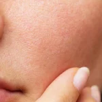 بهترین کرم ضد چروک