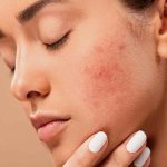 لیزر کیوسوئیچ: کاربردها، مزایا و عوارض