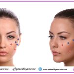 اشتباهات فیلرهای قدیمی و اصلاح علمی آنها