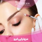 مزایا و معایب مزوتراپی ابرو: آیا این روش برای تقویت و رشد ابروهای شما مناسب است؟ مشاوره با دکتر احمدی