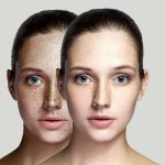 آیا برد پیت از لیزر برای جوانسازی پوست خود استفاده میکند؟ بررسی احتمالات