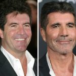 آیا دنزل واشنگتن عمل زیبایی انجام داده؟ نگاهی به جراحیهای زیبایی احتمالی سلبریتیها