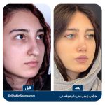 عمل های جراحی زیبایی احتمالی شان پن: بررسی شایعات و واقعیت ها