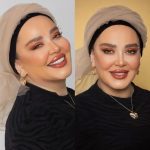 روش های لیفت صورت بهاره رهنما: آیا جراحی بوده است؟