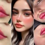 ترند جدید تزریق فیلر در 2025