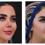 چگونه می‌توان مثل آنجلینا جولی گونه‌های برجسته داشت؟ روش‌های غیرجراحی و جراحی
