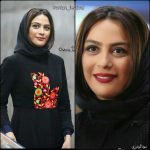 عمل بینی مارال فرجاد: آیا تغییرات زیبایی در چهره او تاثیرگذار بوده است؟