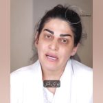 فیلم تزریق فیلر زیر چشم برای رفع تیرگی و گودی توسط دکتر سوسن احمدی + مشاوره آنلاین