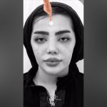 تجربیات واقعی افراد از تغییر صد درصدی چهره با تکنیک‌های زیبایی دکتر سوسن احمدی + ویدیو