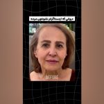 واقعیت زیبایی: دروغهای اینستاگرام و جراحی بینی | دکتر سوسن احمدی