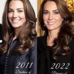 جراحی زیبایی کیت هرینگتون: آیا او عمل زیبایی انجام داده است؟