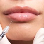 تزریق فیلر لب به سبک نازنین بیاتی: آیا این روش برای شما مناسب است؟
