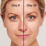 چگونه میتوان پوستی شبیه رایان رینولدز داشت؟ راهنمای جامع جوانسازی پوست