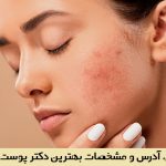بهترین متخصصان پوست و زیبایی در تهران برای داشتن پوستی شبیه اما واتسون