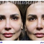 بهترین کلینیک زیبایی برای داشتن چهره‌ای مانند لئوناردو دی‌کاپریو