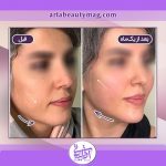 بهترین متخصص پوست برای داشتن پوستی شبیه جوان تر های آل پاچینو کیست؟