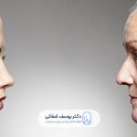 نازنین کریمی بهترین متخصص پوست برای جوانسازی صورت در تهران کیست؟