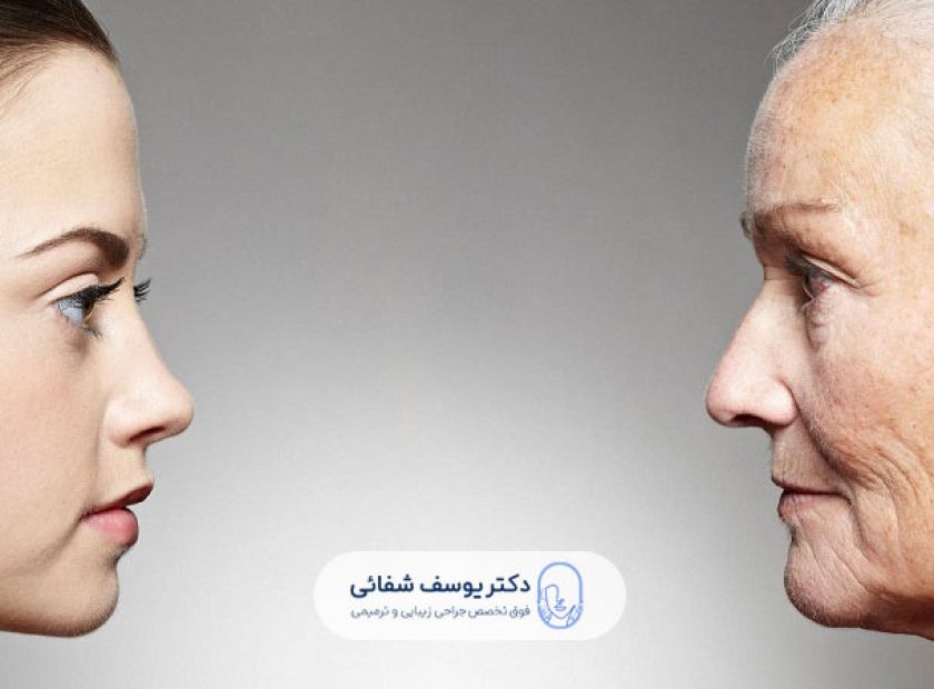 before-and-after-face-lift