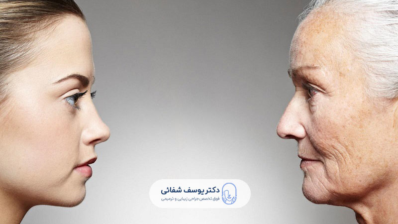 before-and-after-face-lift