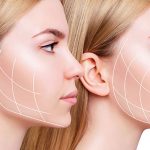 فرمدهی چانه با فیلر برای چه کسانی مناسب است؟ بررسی کاندیداهای ایدهآل و انتظارات واقعبینانه