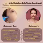 تفاوت مزوتراپی و میکرونیدلینگ