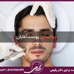 مقایسه روش های جوانسازی پوست آقایان: از آل پاچینو تا برد پیت