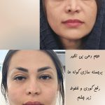 جدیدترین متدهای تصحیح فرم صورت: مشاوره با دکتر سوسن احمدی برای انتخاب بهترین روش