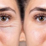جراحی پلک هیو جکمن: بررسی احتمال و تاثیر آن بر جذابیت چهره او