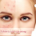 چطور بفهمیم پوستمان خشک است یا کم آب؟