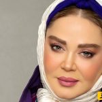 آیا بهاره رهنما تزریق بوتاکس انجام داده؟ نظر متخصصان