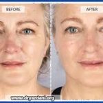 مقایسه روش های درمان پوستی دنیل دی لوییس با متدهای رایج در ایران