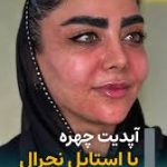 بهاره رهنما و فیلر لب: نظر شما درباره تغییرات صورتش چیست؟