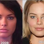 جوانسازی صورت به روش مارگو رابی: معرفی روش های جایگزین جراحی