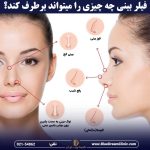فیلر بینی برای اصلاح قوز بینی بعد از عمل: هر آنچه باید بدانید