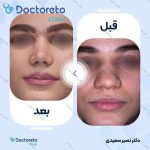 مدیکال راینوپلاستی دکتر سوسن احمدی: هزینه، مزایا و مراقبت های بعد از عمل