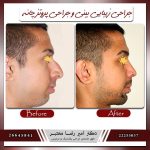 آیا هیو جکمن عمل زیبایی انجام داده است؟ بررسی شایعات و واقعیت های جراحی زیبایی مردان