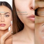 بهترین دکتر پوست و جراح زیبایی برای داشتن چهره ای جوان مانند رابرت دنیرو در تهران