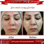 آیا هیو جکمن لیزر پوست انجام داده است؟ بررسی درمان های جوانسازی احتمالی او