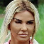 واقعا بوتاکس باعث چهره یخ زده میشه؟