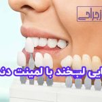 راز لبخند زیبای جنفر لارنس: ارتودنسی، لمینت دندان یا روش‌های دیگر؟