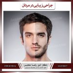 جراحی های زیبایی مردان: آیا آل پاچینو جراحی پلاستیک انجام داده است؟