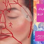 عوارض احتمالی فتگرفت: آگاهی از خطرات تزریق چربی برای جوانسازی صورت